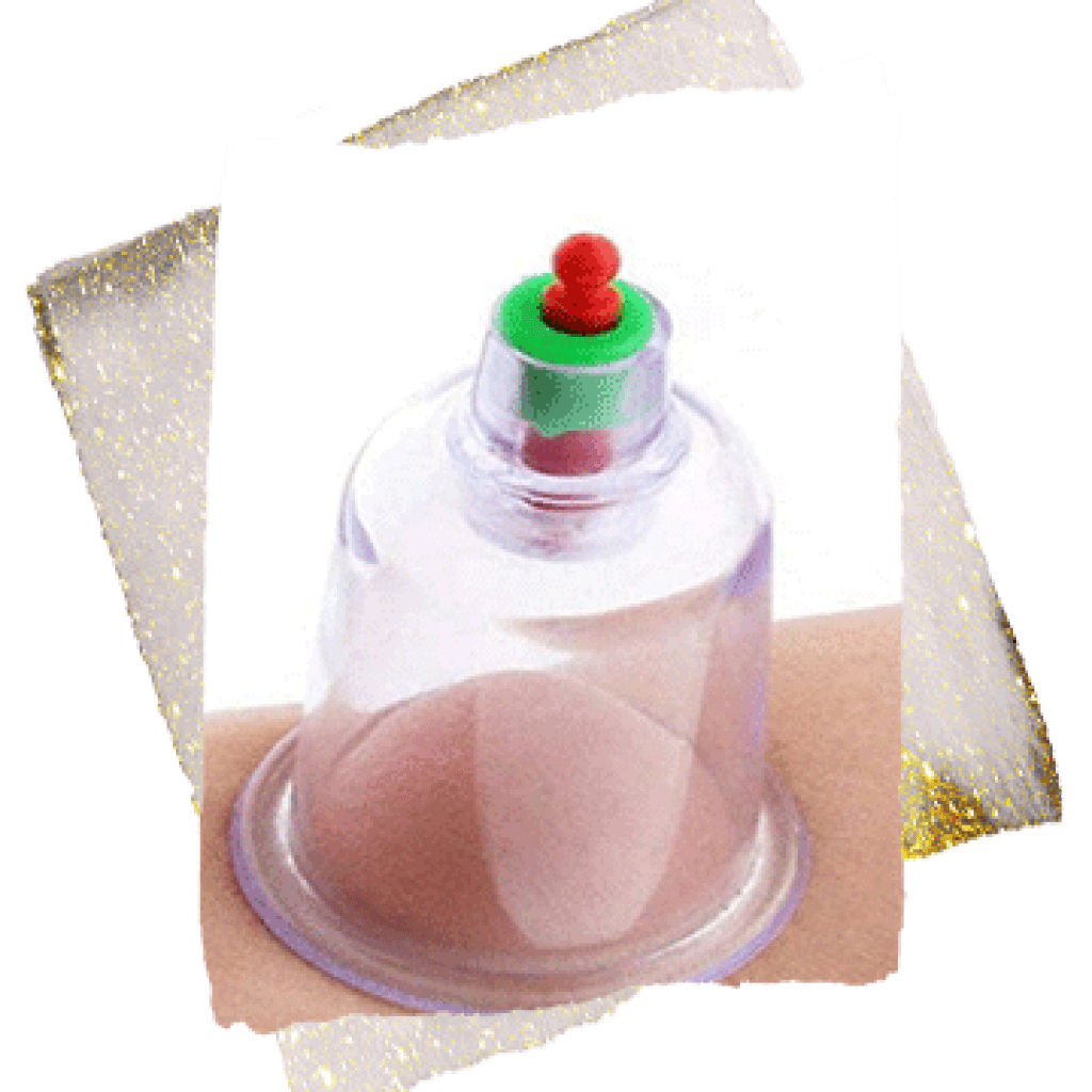 best hijama clinic in dubai