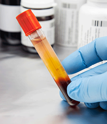 rich plasma sessions for hair treatment