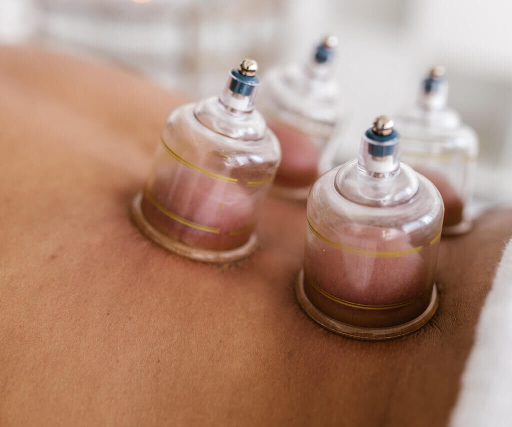 Hijama And Immune System