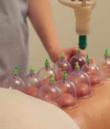 holistic hijama