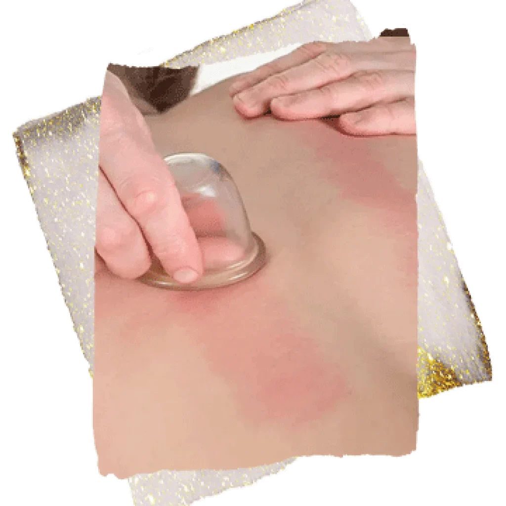 Cupping-Massage-1024x1024