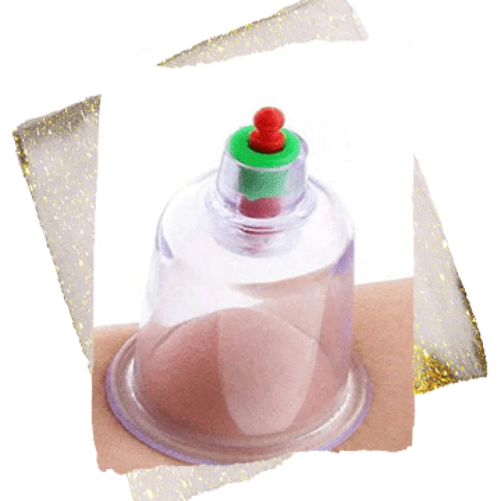 hijama