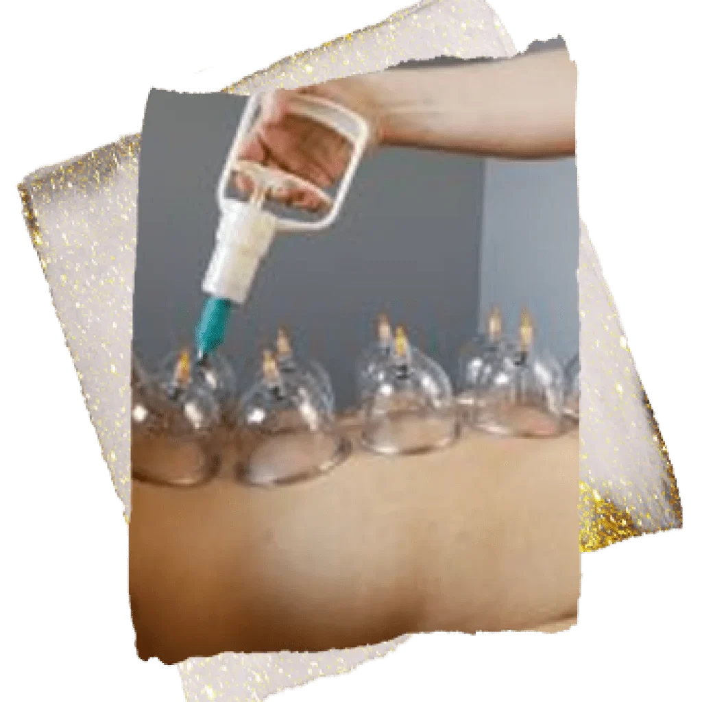 Post-Cupping-Instructions-1024x1024
