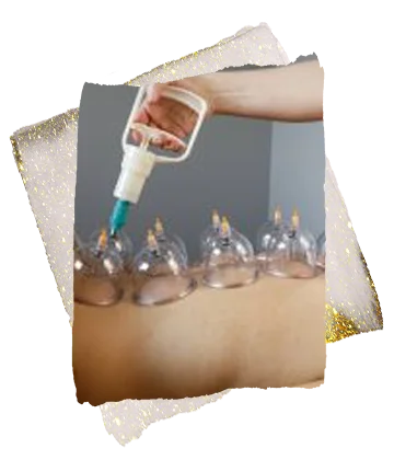 hijama