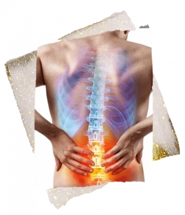 Therapeutic-Cupping-368x428