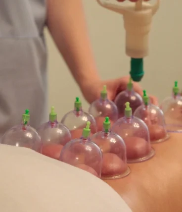 hijama